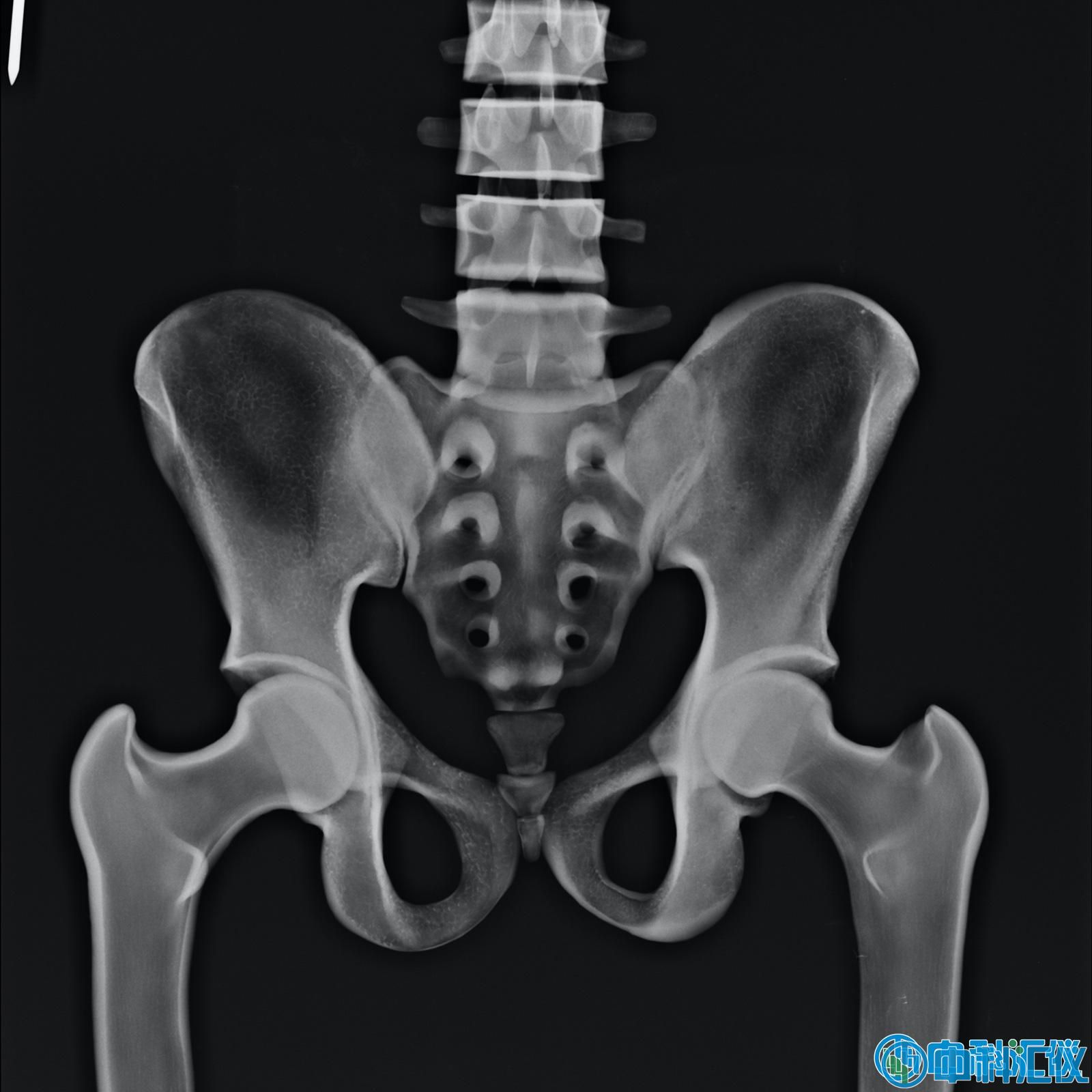 RS113_Clinical_001.jpg