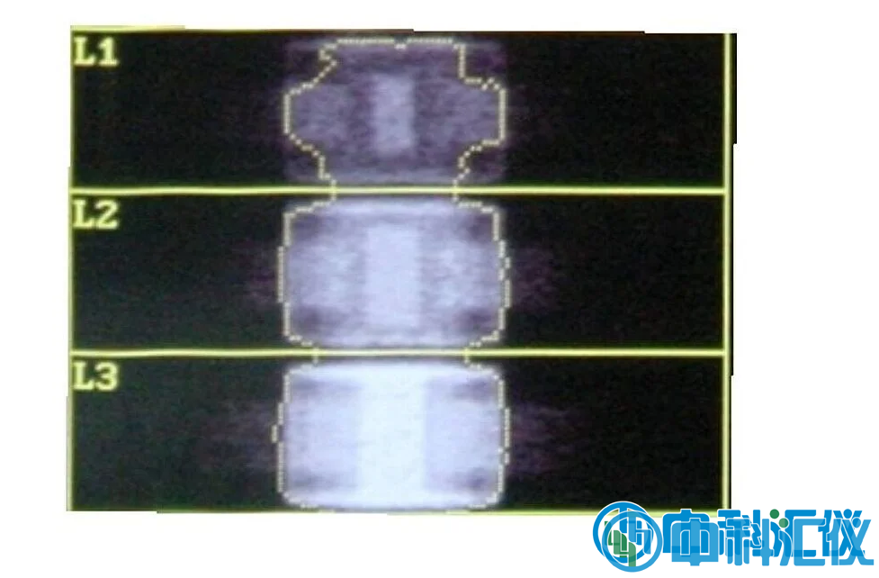 QRM-ESP 的 DXA 扫描（说明见以上文字） (1).png