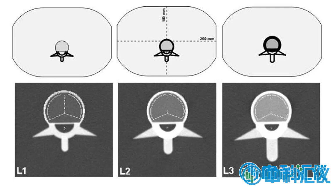 QRM-ESP 的 CT 图像。椎体中段扫描图像，并叠加了自动确定的松质骨和皮质骨 ROI。.png
